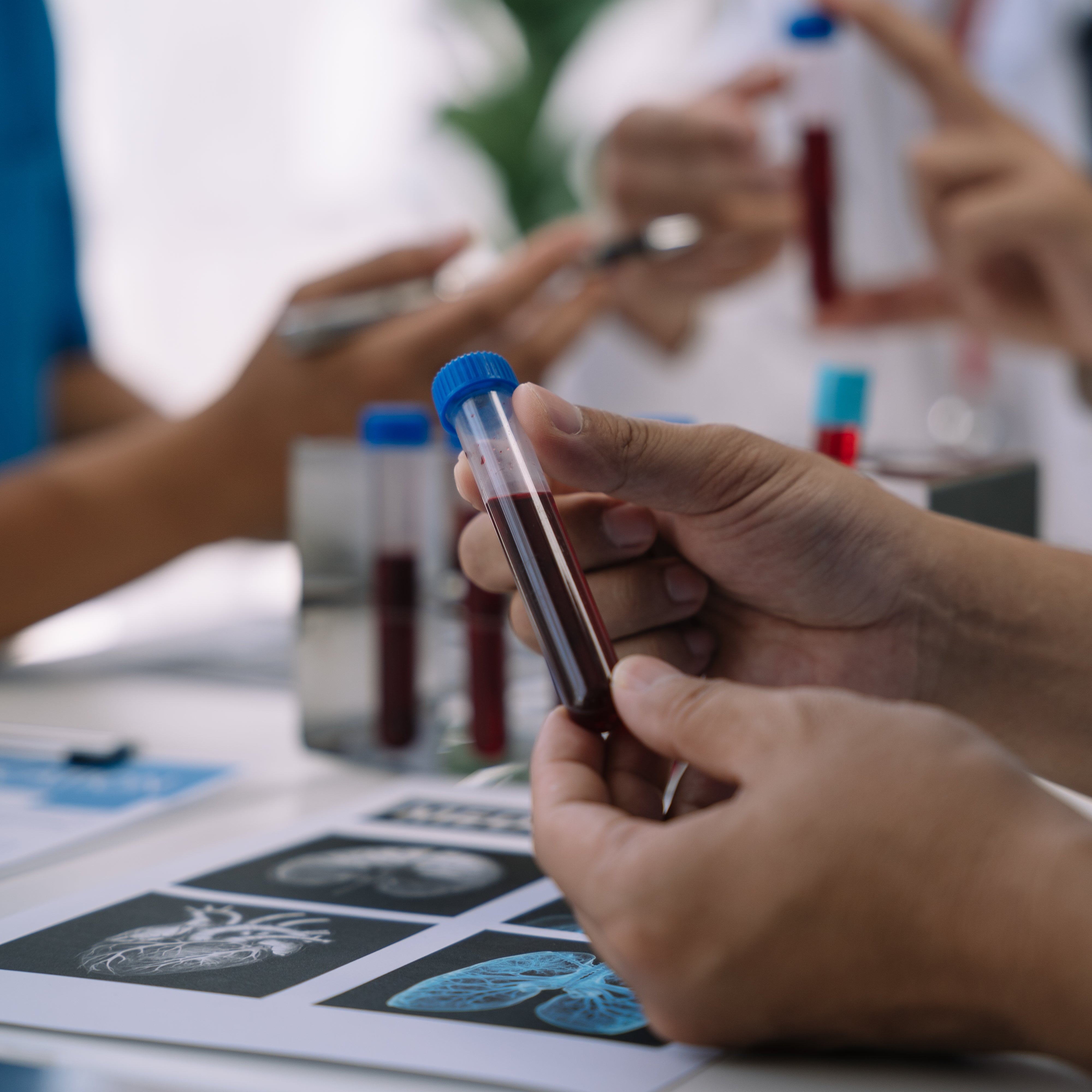 Leitfaden zur Interpretation von Schilddrüsen-Blutwerten