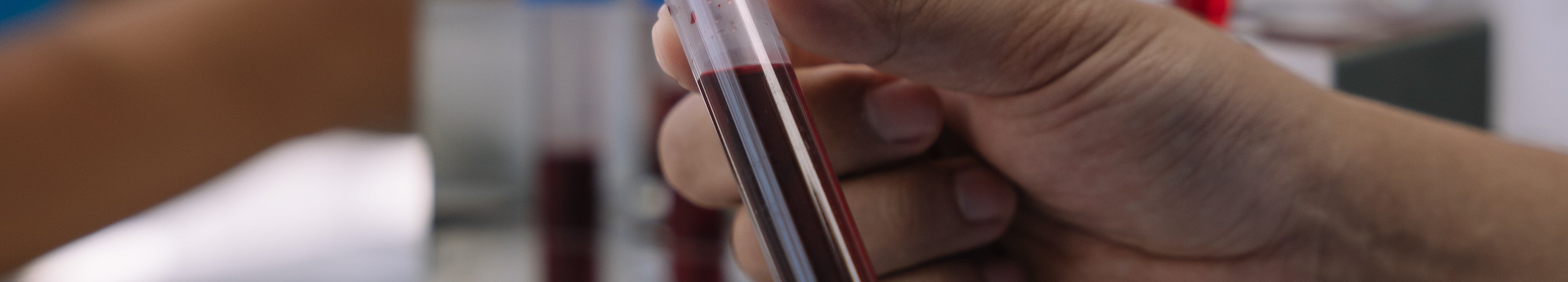 Leitfaden zur Interpretation von Schilddrüsen-Blutwerten